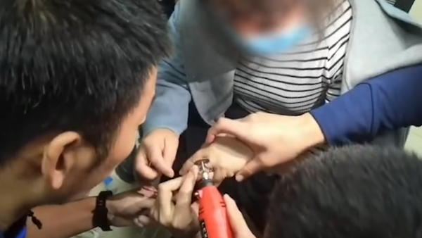 惊险一幕！女生手卡在男生嘴里，紧急求助医院