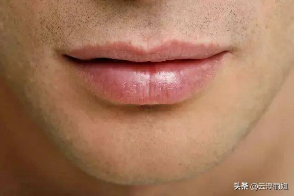 男子惊现奇异变化，下唇厚达上唇两倍，真相令人震惊！